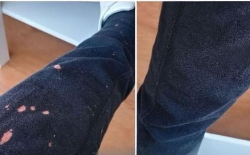 Como remover manchas de água sanitária ou alvejante das roupas: Estratégias simples e eficientes
